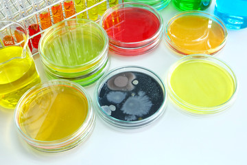 microorganism in petridish