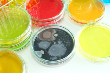 microorganism in petridish