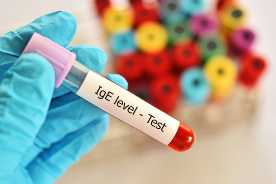 Blood sample tube for Immunoglobulin E or IgE level test, diagnosis for allergy disease