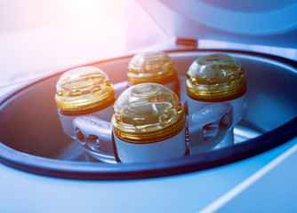 Platelet-Rich plasma preparation. Centrifuge. Medical