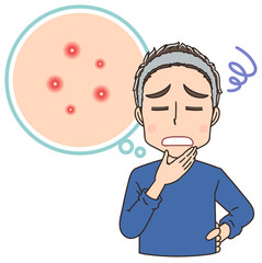にきび 吹き出物 悩み 男性