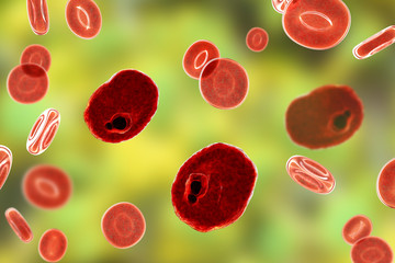 Fototapeta premium The malaria-infected red blood cells. 3D illustration showing malaria parasite Plasmodium ovale in the stage of ring-form trophozoite