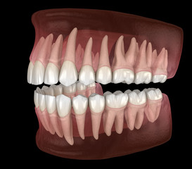 Morphology of mandibular and maxillary human gum and teeth. Medically accurate tooth 3D illustration