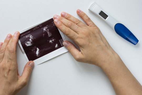 Woman hands holding picture of ultrasound of embryo on white background and pregnant test