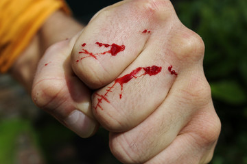 Man's hand has been freshly scratched by a cat in the garden. Fresh blood is coming out out of the skin layer. Splash of blood drops on a white flower