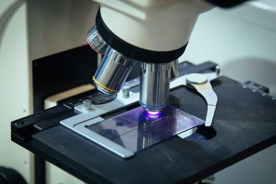 Scientific or medical test sample under light microscope in laboratory, close up