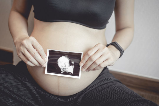 woman holding ultrasound her baby's photo
