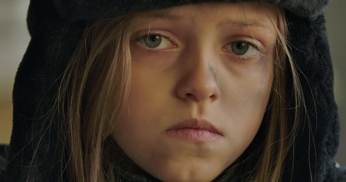 Close-up face of Ukrainian refugee with grey eyes wearing hat with earflaps looking at the camera. Hopeless little girl living on the streets.