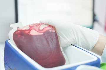 Selective focus scientist hand holding red blood bag in storage blood bag for transfer from...