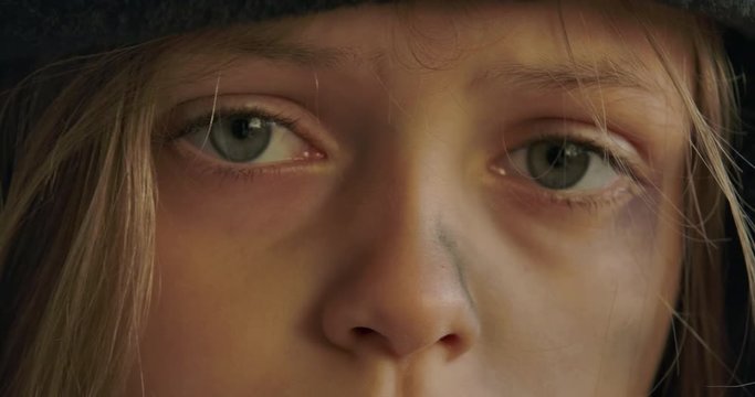 Extreme close-up of a homeless girl with grey eyes looking at the camera. Sad refugee with dirty face living on the streets.