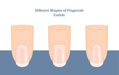 Different Shapes of Fingernail Cuticles. Manicure Guide. Vector illustration