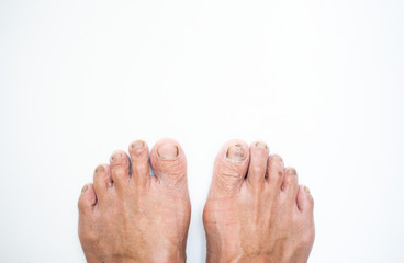 The surface of the elderly feet
