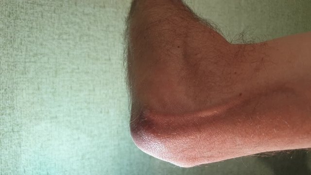 Pain in the elbow. Elbow joint. Man elbow.