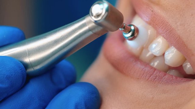 process of teeth polish close up