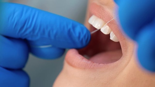 process of cleaning teeth with dental floss during dentist visit close up
