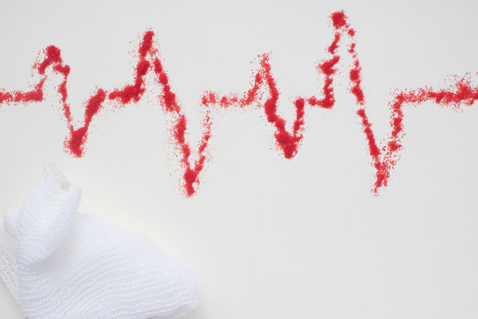 concept of medical care, heart rate, cardiograms, ECG