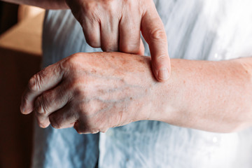 Older woman hands. Rheumatism, arthritis, joint pain