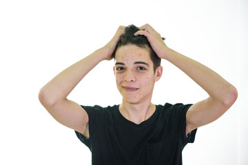 Young guy wants to get rid of acne on his face