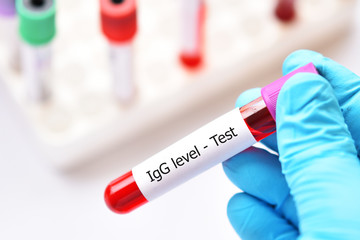 Obraz premium Blood sample tube for Immunoglobulin G or IgG level test, diagnosis for immunodeficiency disease