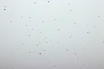 Sperm cells or spermatozoa in semen, analyze by microscope, 400x