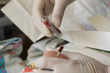 hand blood test of a baby in a hospital nursery. nurse with gloves.