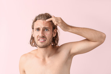 Portrait of young man with acne problem on color background