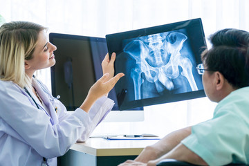 Caucasian female doctor showing Asian patient the film of x-ray scan of the pelvis.