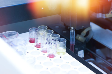 medical automatic urine and blood analyzer