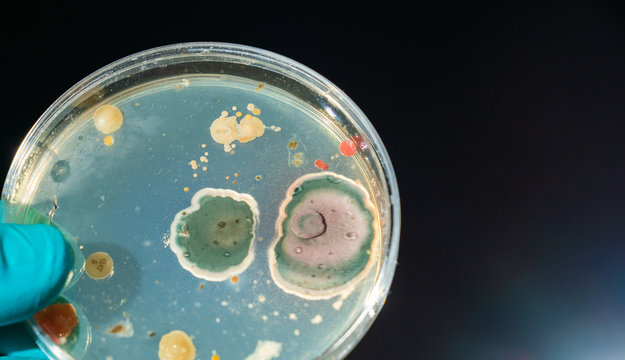 petri dish with microbe colony in doctor hand