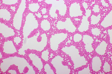 Red blood cells in blood smear, Wright-Giemsa stain, analyze by microscope, 400x