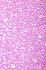 Red blood cells in blood smear, Wright-Giemsa stain, analyze by microscope, 400x