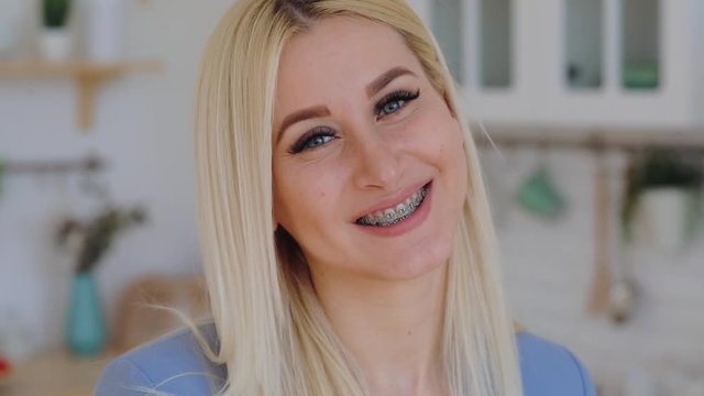 beautiful satisfied woman with blonde hair demonstrates brackets on teeth standing against kitchen closeup slow motion