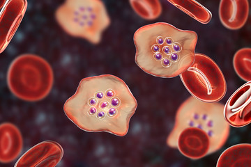 The malaria-infected red blood cells. 3D illustration showing malaria parasite Plasmodium ovale in the stage of ring-form trophozoite
