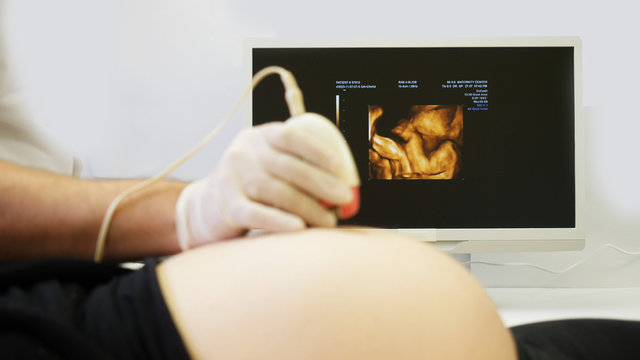 Detail of doctor hand on pregnant belly, ultrasound pictures on monitor