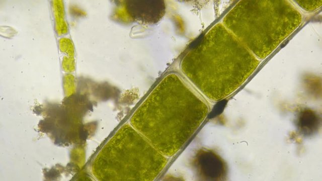 Ciliate swimming among vegetation
