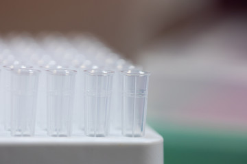 Polymerase Chain Reaction (PCR) and Agarose gel electrophoresis is a method of gel electrophoresis used in biochemistry, molecular biology, genetics, and clinical chemistry in lab.