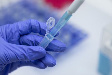 Polymerase Chain Reaction (PCR) and Agarose gel electrophoresis is a method of gel electrophoresis used in biochemistry, molecular biology, genetics, and clinical chemistry in lab.