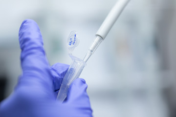 Polymerase Chain Reaction (PCR) and Agarose gel electrophoresis is a method of gel electrophoresis used in biochemistry, molecular biology, genetics, and clinical chemistry in lab.