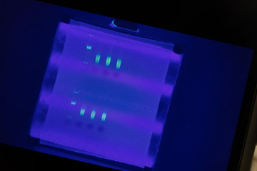 Polymerase Chain Reaction (PCR) and Agarose gel electrophoresis is a method of gel electrophoresis used in biochemistry, molecular biology, genetics, and clinical chemistry in lab.