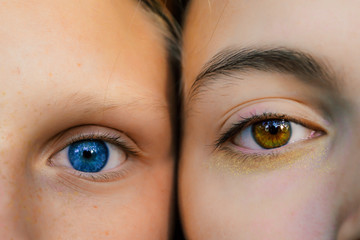two girls with different eyes touch their cheeks, photo near. The first has a clear blue color, the...