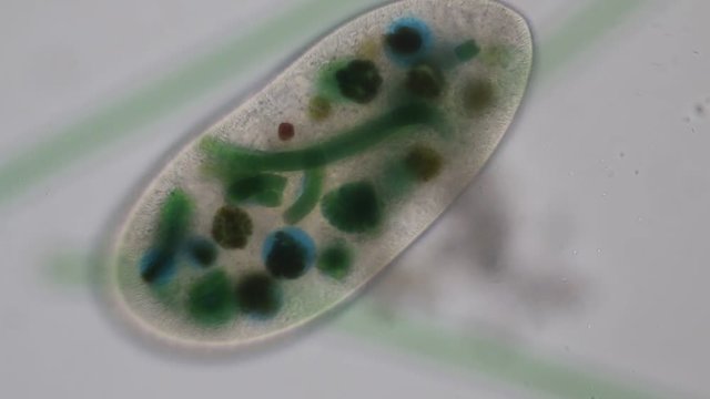 Frontonia sp. is a genus of free-living unicellular ciliate protists under the microscope.