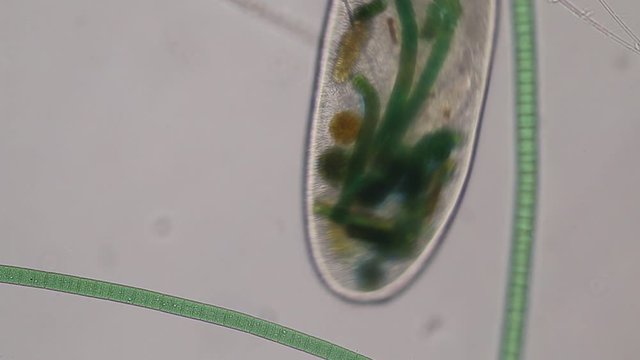 Frontonia sp. is a genus of free-living unicellular ciliate protists under the microscope.