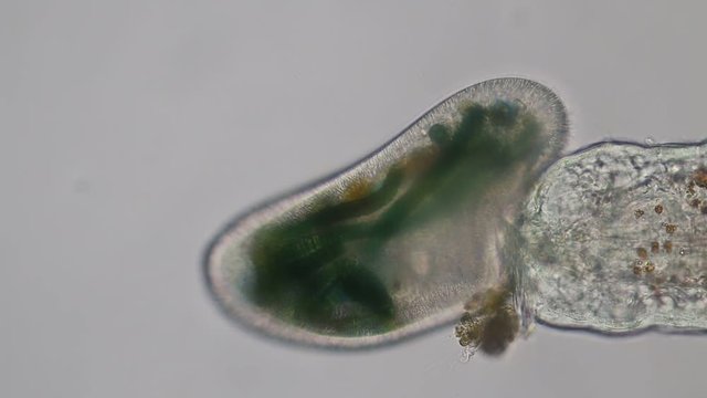 Frontonia sp. is a genus of free-living unicellular ciliate protists under the microscope.