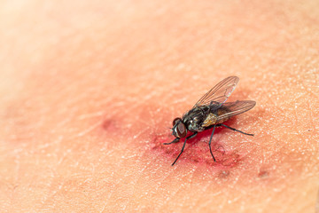 Fly swarming the wound on the skin.