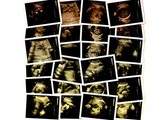 Collection of images from ultrasound scan examination