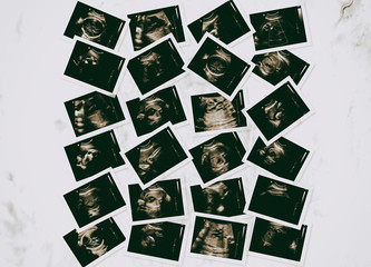 Fototapeta na wymiar Collection of images from ultrasound scan examination