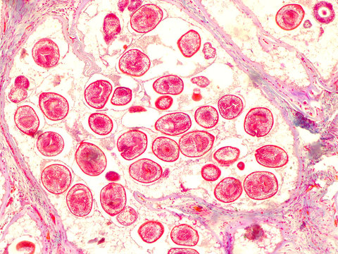 Echinococcal Cyst Under The Microscope (400x). Echinococcus Granulosus. Dog Tapeworm Parasite.