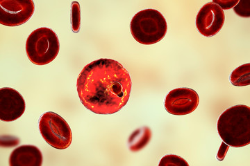 The malaria-infected red blood cell. 3D illustration showing parasite Plasmodium malariae in the stage of ring-form trophozoite