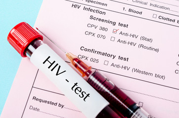 Sample blood in blood tube with HIV test label with needle and syringe.