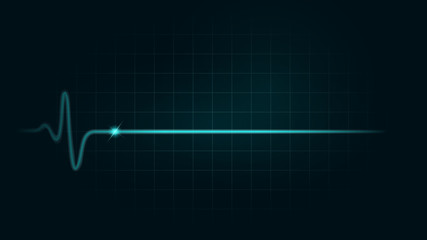 Pulse rate Line while dead on green chart background of monitor. Illustration about heart failure and Cardiogram monitor.